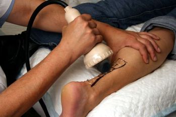 CellSonic ESWT aşil tendonu tedavi protokolü